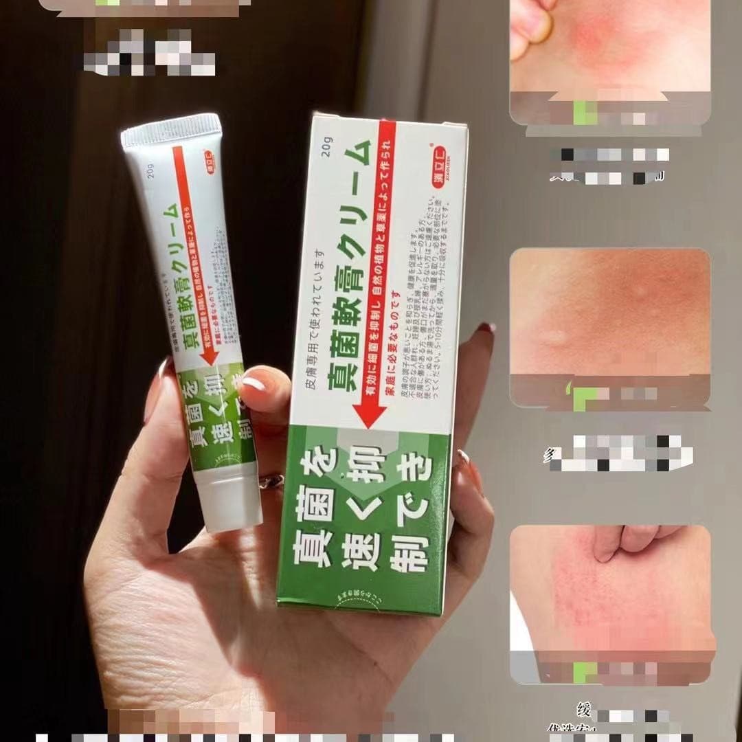 Xiaoliren Fungus Wang Antibacterial Ointment Antipruritic Antibacterial Ointment Skin Itching Tinea
