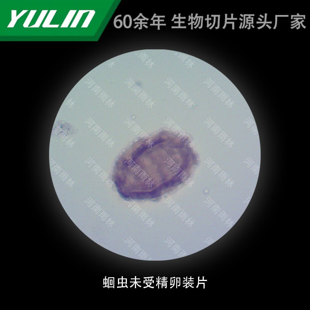 Unfertilized Ascaris Egg Slide, Histopathology Paraffin Section Specimen for Medical College Microscopy