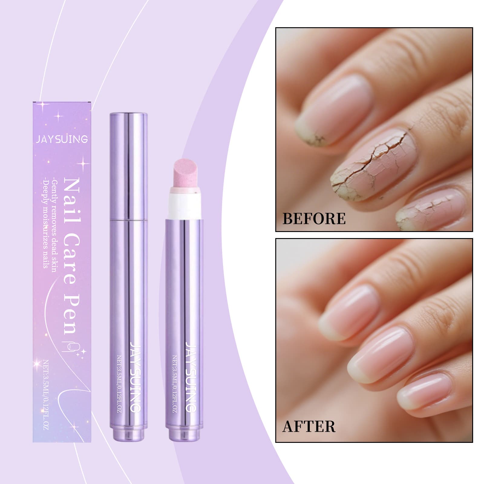 Jaysuing Nail Essence Care Pen Nourishes Nail Cuticles, Brightens Nail Surface, Soft Nail Cleaning Care Pen