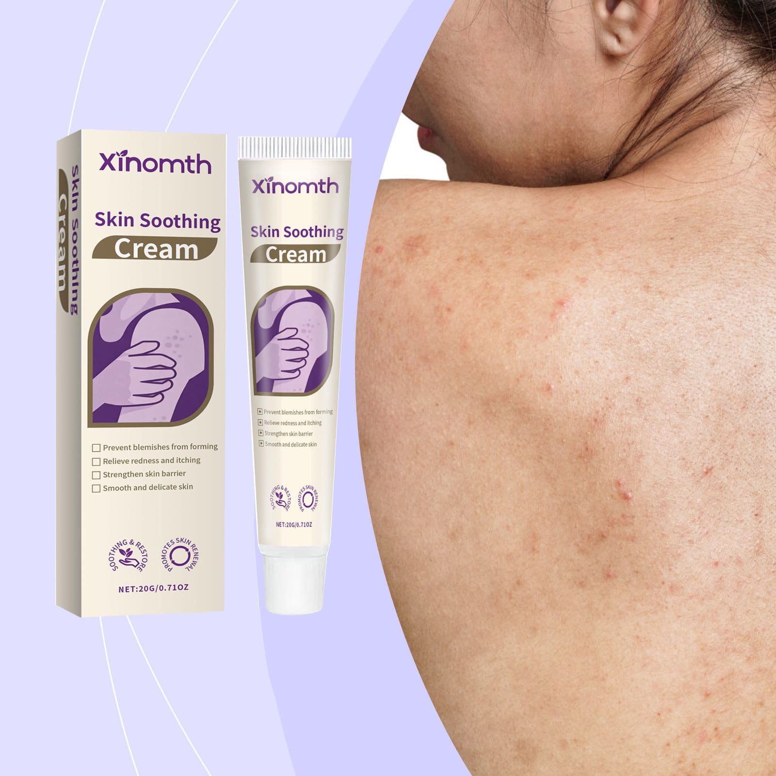 XINOMTH Skin Care Cream Acne Treatment Herbal Cooling Smoothing External Care Ointment