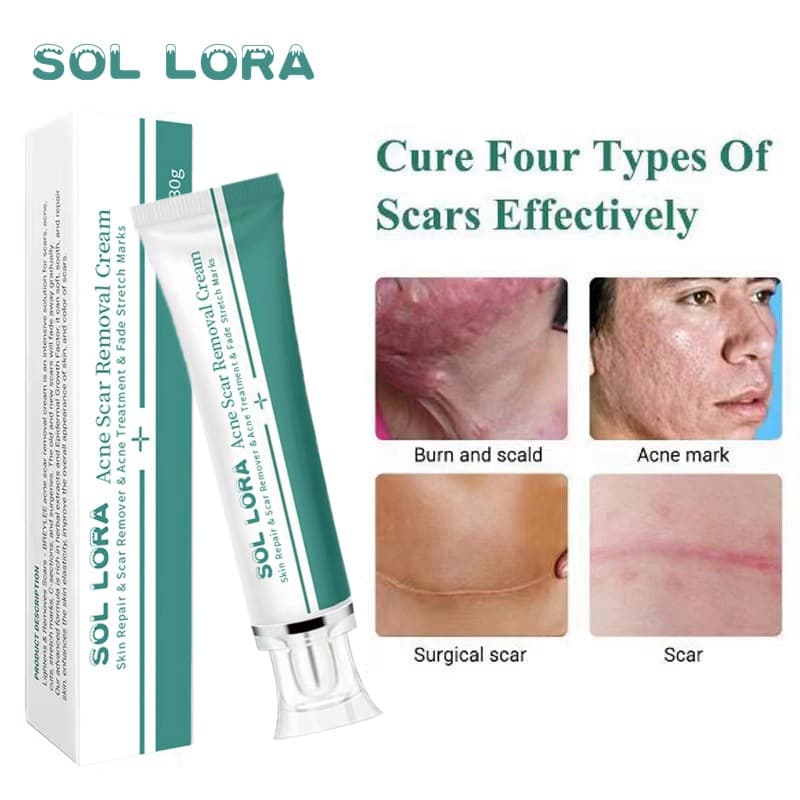 SOL LORA Cross-Border Skin Repair Cream Scar Fading