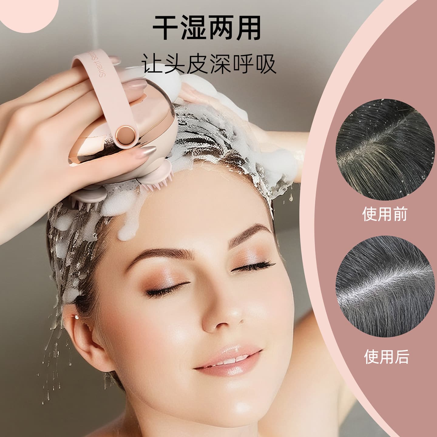 Cross-border Special Head Massager for Stress Relief, Acupoint Scalp Meridian Red Light Massager, Portable Pet Massager