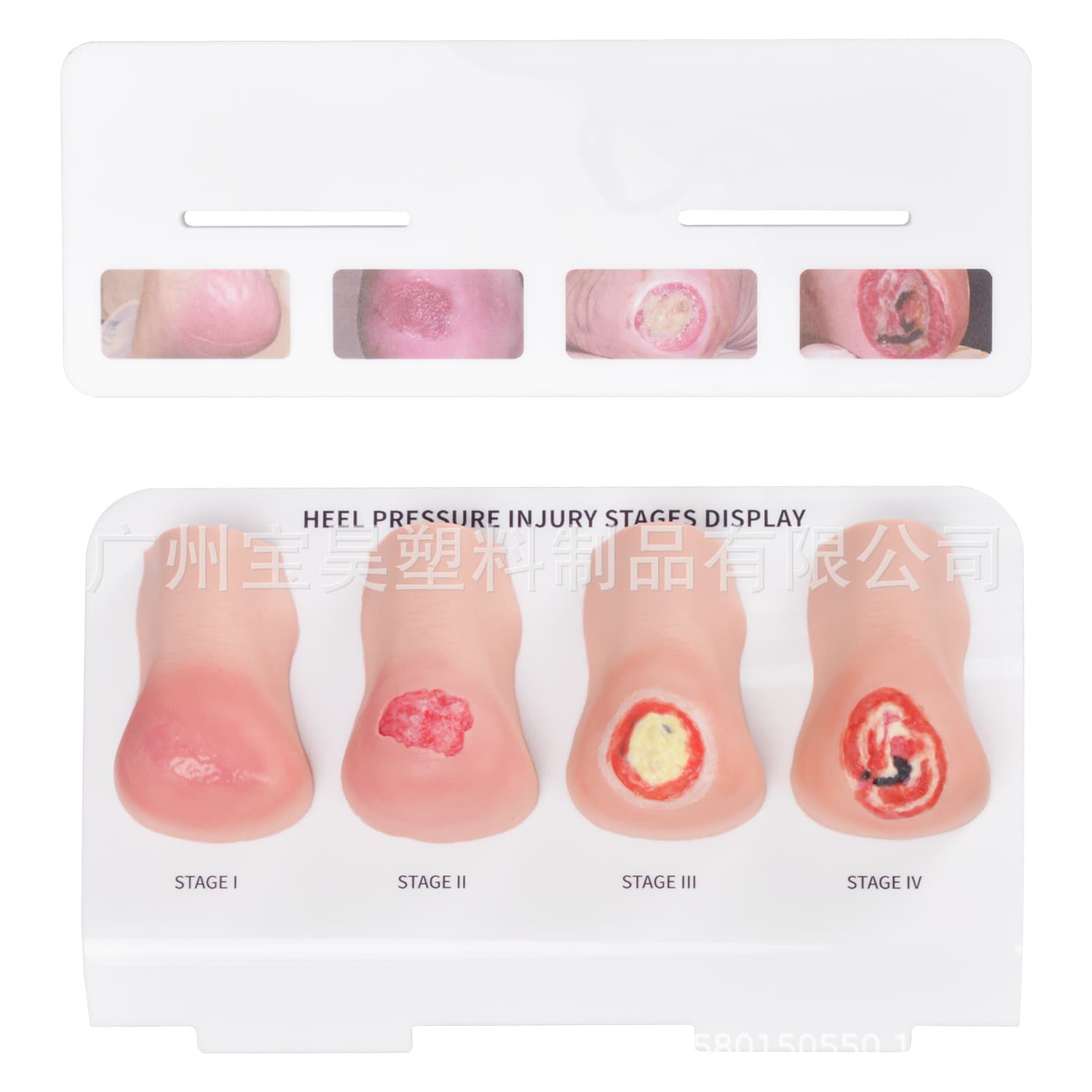 Teaching Model, Display Model of Heel Pressure Sore, Heel Wound Model, Foot Model