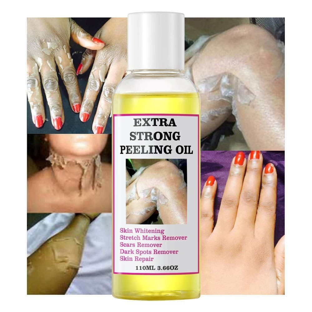Exfoliating Oil for Elbows, Knees, Fingers, Dark and Yellow Skin, Hand, Foot, and Body Oil for Foreign Trade