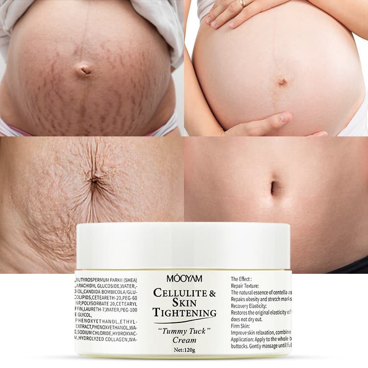 Stretch Mark Cream Firming and Nourishing Body Cream for Postpartum and Pregnancy Stretch Marks Repair
