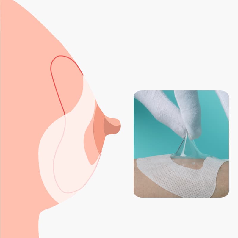 Nipple Shield Fixing Stickers, Nipple Shield Aid Patches, Nursing Nipple Aid Anti-Drop Breathable Patches, 30 Pieces Pack