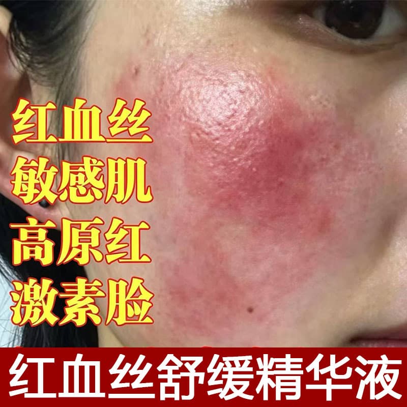 Special skin care products for beauty salons: chamomile to soothe red blood cells on sensitive skin, repair and repair cuticle essence lotion
