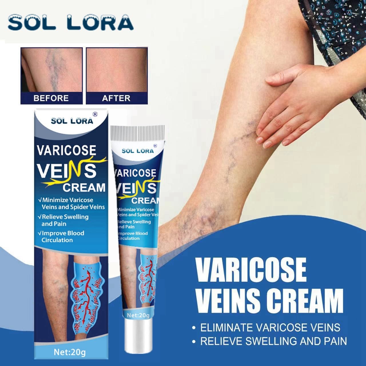 SOL LORA Cross-border Amazon Wish AliExpress Vein Cream Blue Vein Relief Ointment Earthworm Leg Cream