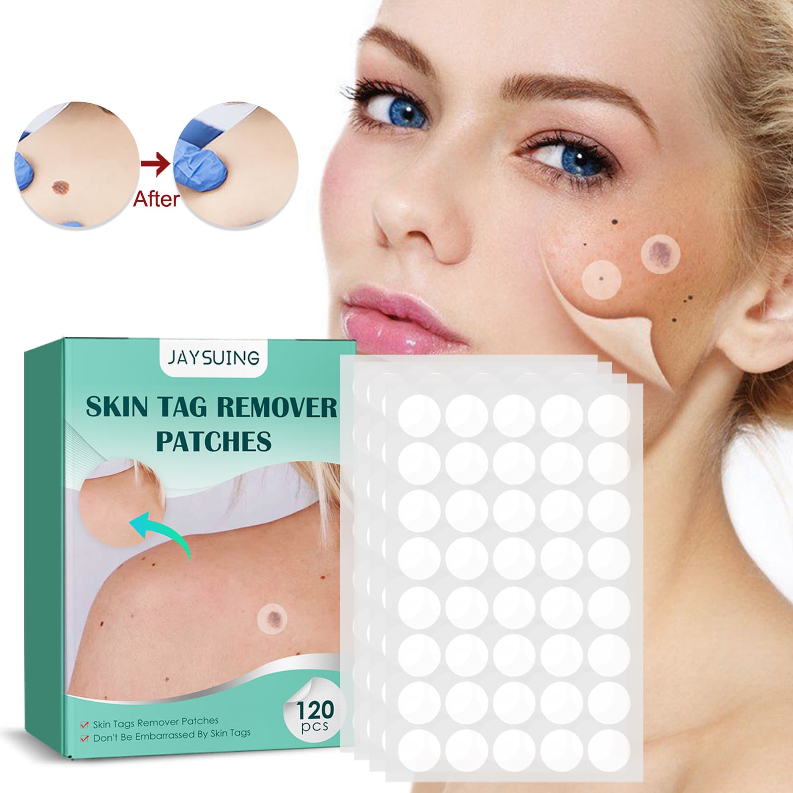 Jaysuing Wart Removal Patches - Skin Cleansing and Wart Removal Care Patches for Acne, Corns, Warts, Mucus, and Moles