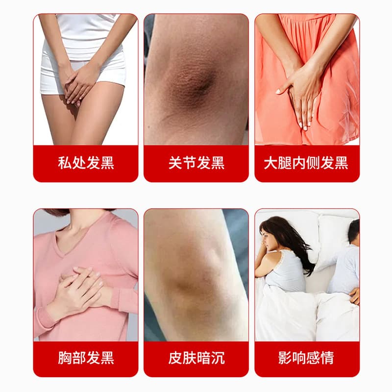 Thailand Private Honey Pink Whitening Cream Soothes Female Intimate Area Darkening, Nipple Whitening Cream, Drop Shipping