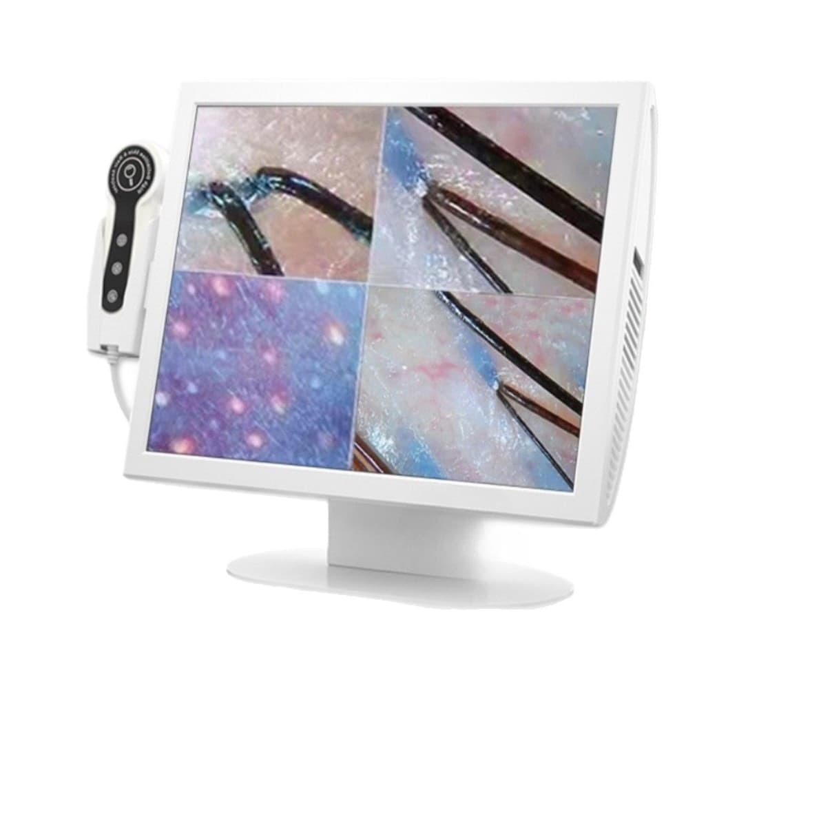 15-inch Tablet Hair Analyzer Follicle Hair Analysis Skin Tester Quadrant UV Hair Detection Device