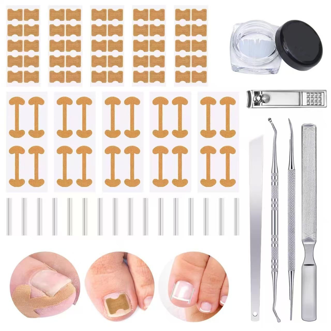 Cross-border 30 Filling Pads - Ingrown Toenail Corrector Tweezer, Nail Lifter, Paronychia Straightening Patch, C-shaped Slot, Toe Inflammation Kit