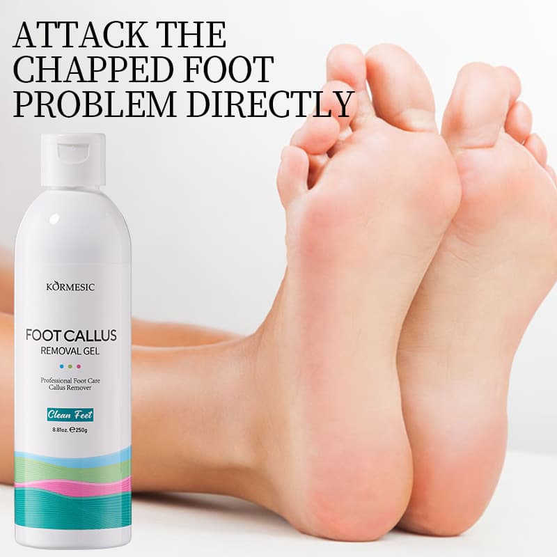 KORMESIC Foot Care Gel Anti-Dryness Gel, Hydrating and Moisturizing, Removes Calluses, Prevents Cracking, Moisturizing Foot Care Cross-border Trade