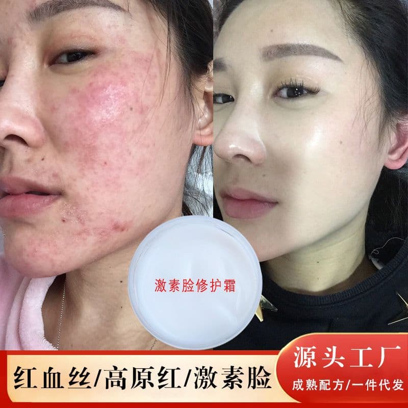 Sensitive Skin Repair Cream for Redness, Broken Capillaries, Red Face Improvement, Thin Stratum Corneum, Soothing and Restoring Face Cream
