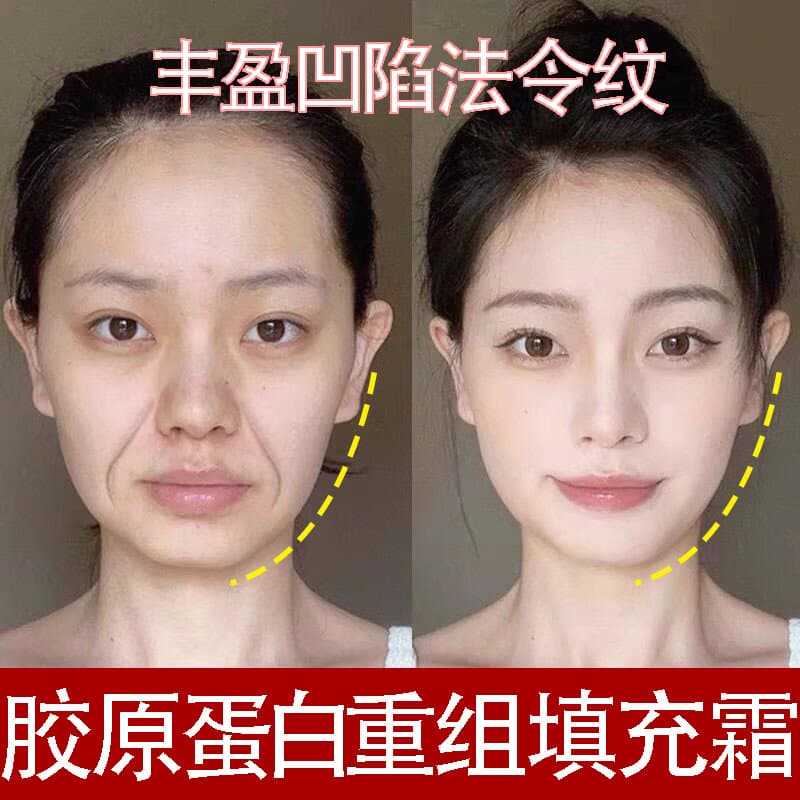 Collagen Filling Cream, Wrinkle-Reducing Firming Cream, Forehead Line Treatment, Anti-Aging, Depletion Filling, Skin-Smoothing Cream, Restructuring Cream