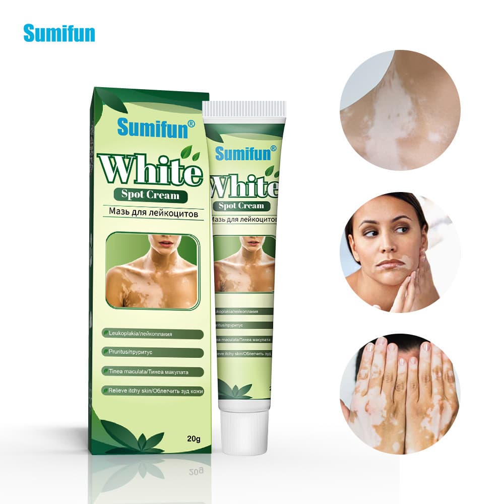 Sumifun Cross-border Amazon Tinea Versicolor Care Cream White Spot Clean Tinea Versicolor Sweat Spot Skin Cream DZ1002002