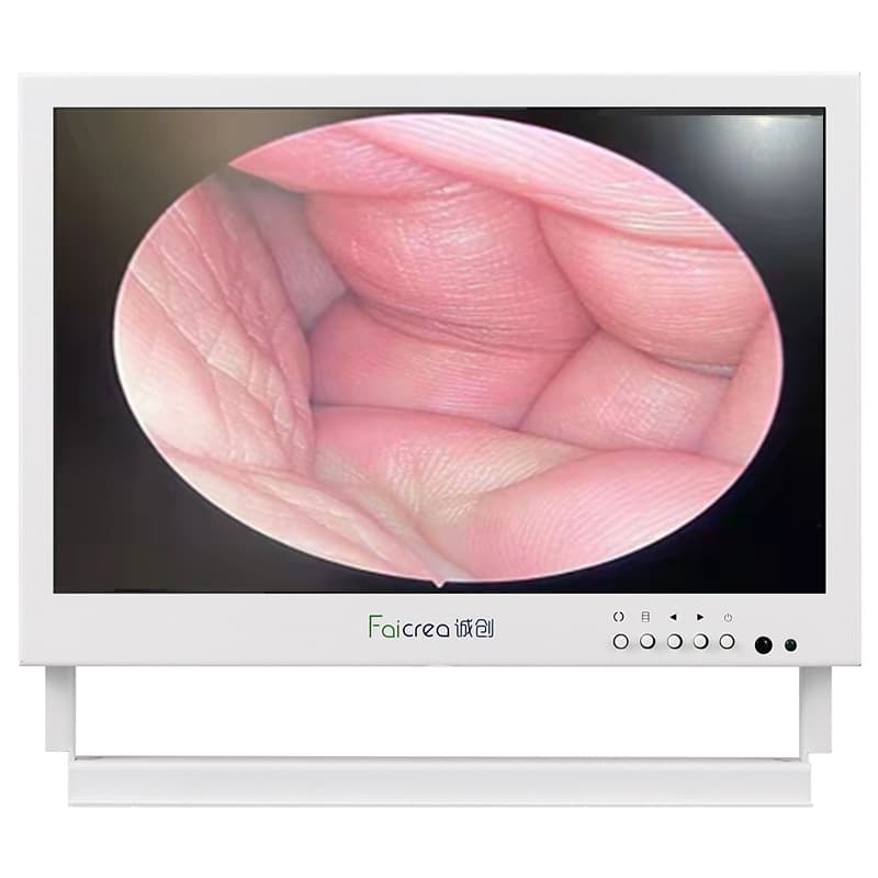 LCD Display for Ear Cleaning, Medical Photography, Fixed Endoscope Camera Microscope Monitor with HD Display