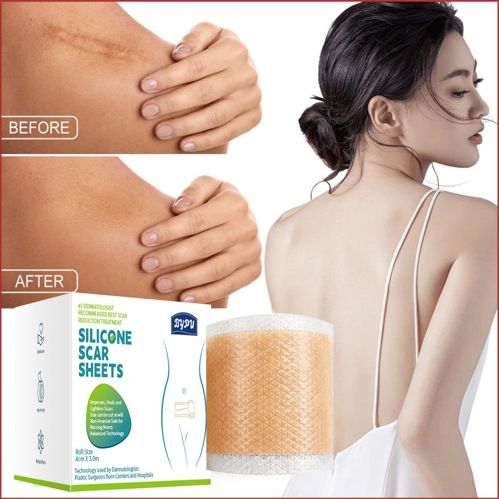 Silicone Scar Care Patch Daily Gentle Care Body Skin Breathable Comfort Skin Care Cross-Border Hot Sale