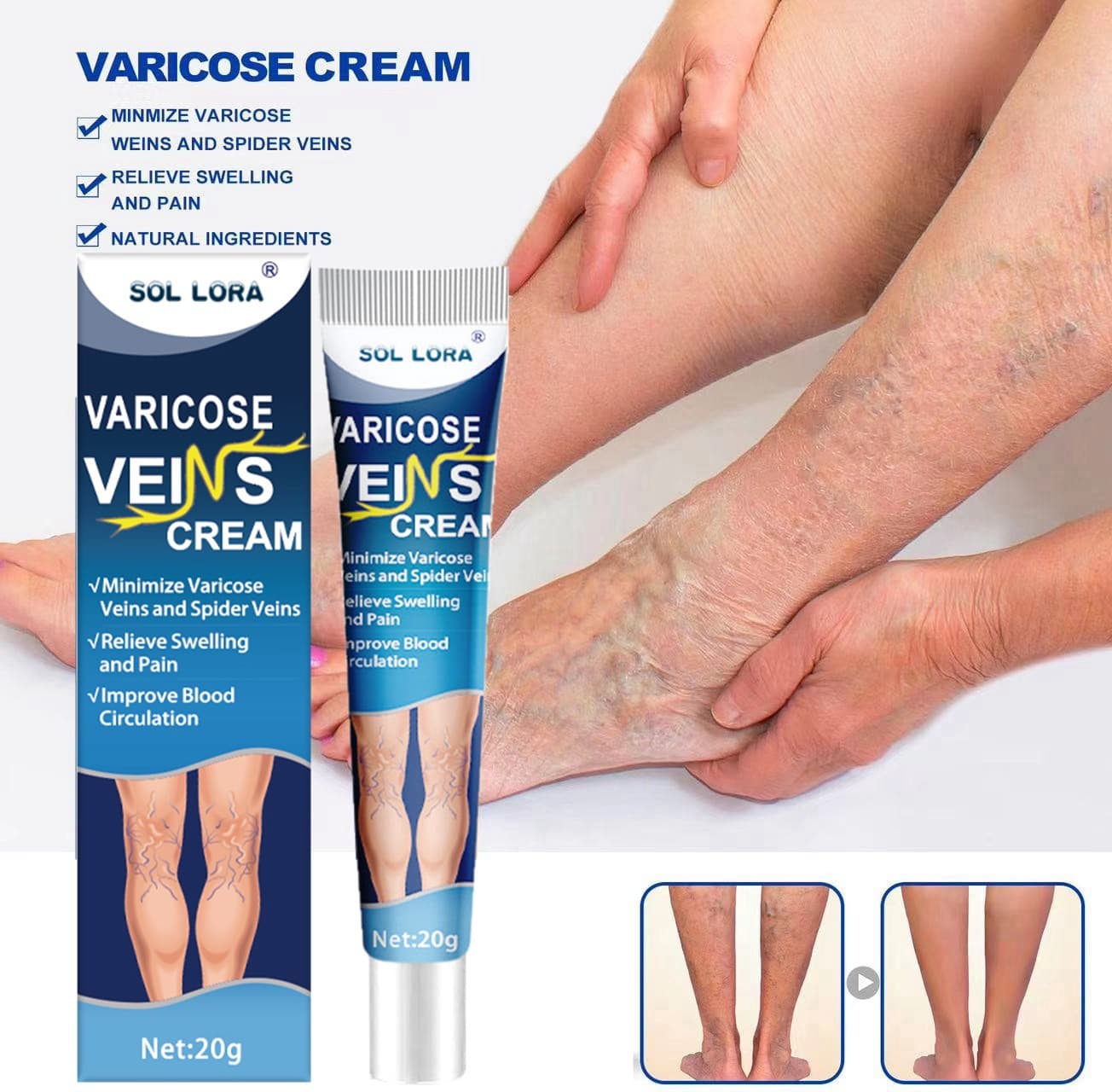 SOL LORA Cross-border Amazon Wish AliExpress Blue Vein Cream Pulse Comfort Ointment Earthworm Leg Cream