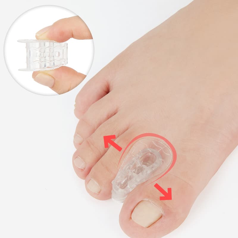 New toe separator, hallux valgus corrector, overlapping separator, bunion orthosis, toe clip manufacturer