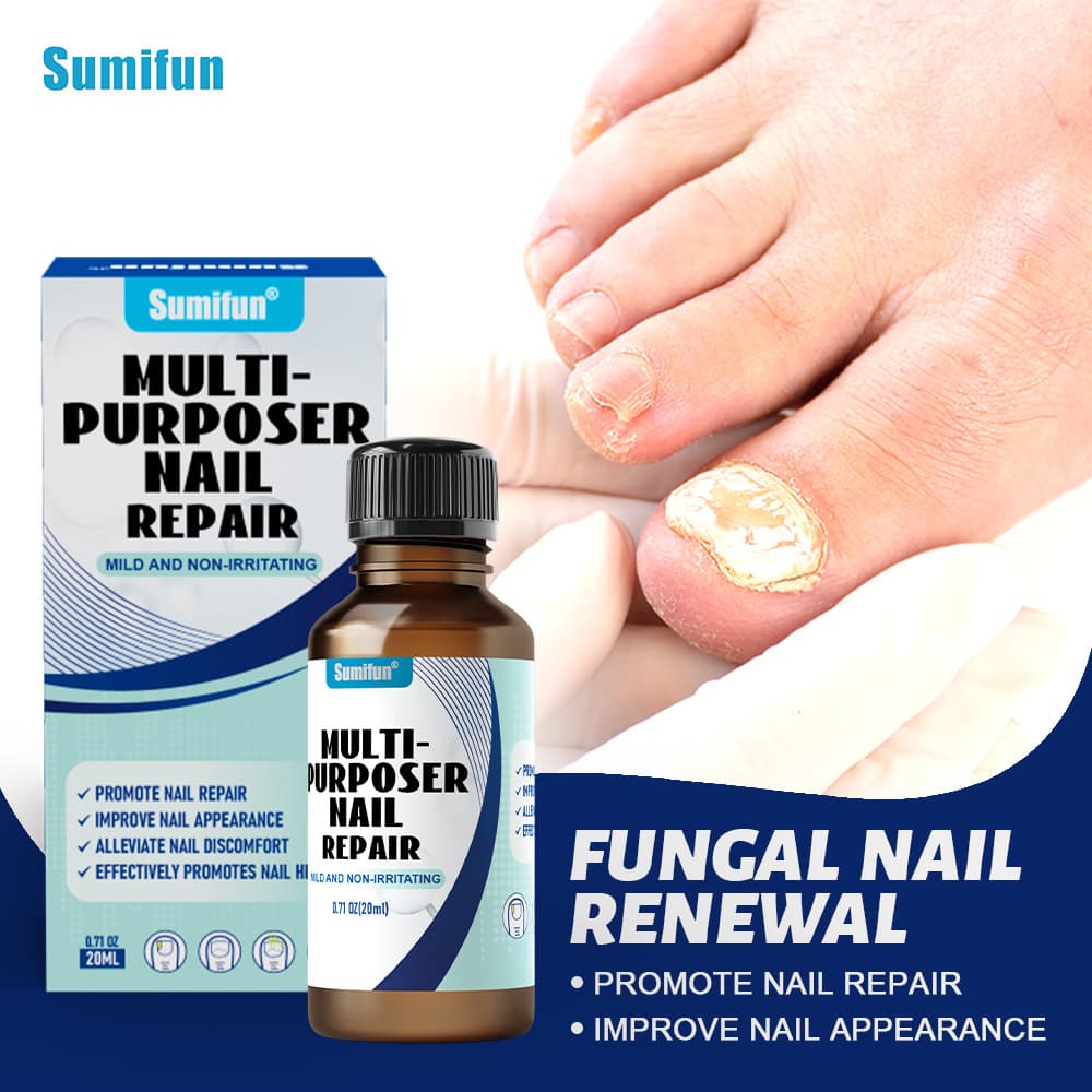 Sumifun Nail Repair Liquid Tiktok Amazon Coupang Cross-border Nail Liquid Bright Potassium Nail Care K60009
