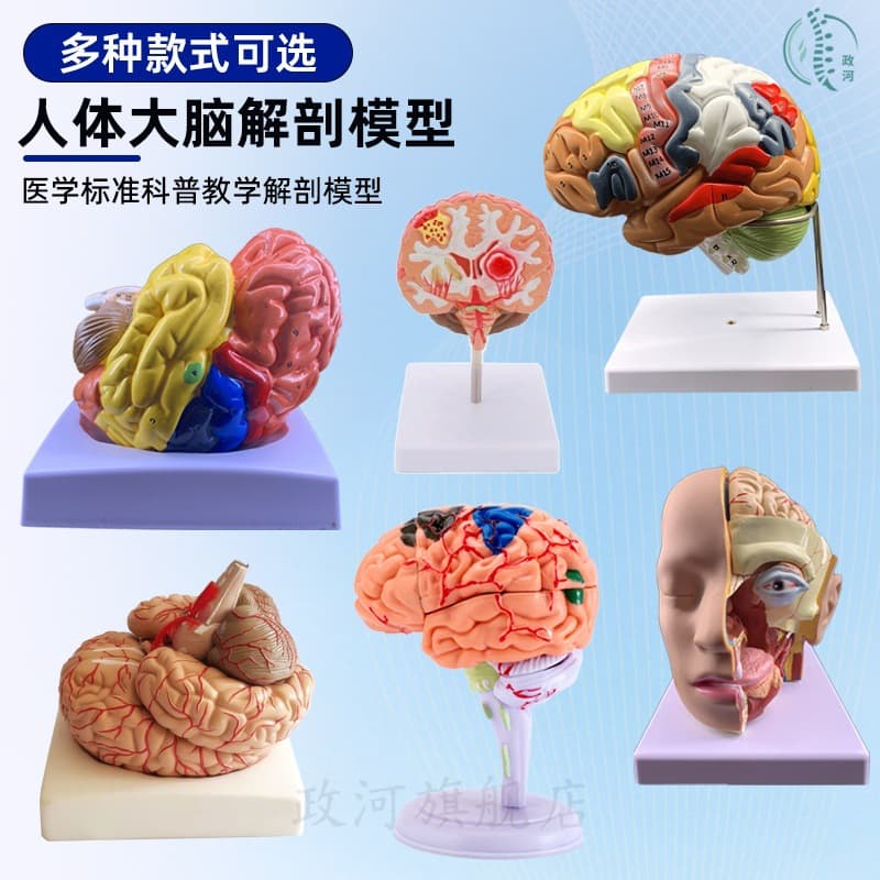 Teaching Simulation Human Brain Anatomy Model, Cerebral Artery Structure, Cranial Nerves, Brain Mold, Color-Coded Functional Areas