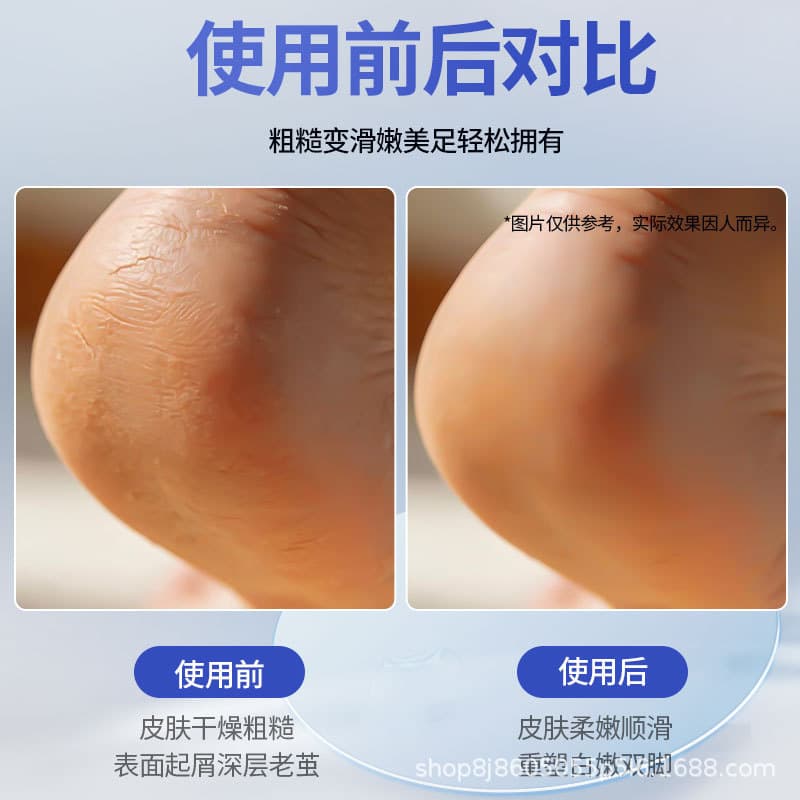 Electric Foot File Multi-Function Callus Remover Pedicure Tool Automatic Dead Skin Remover for Feet