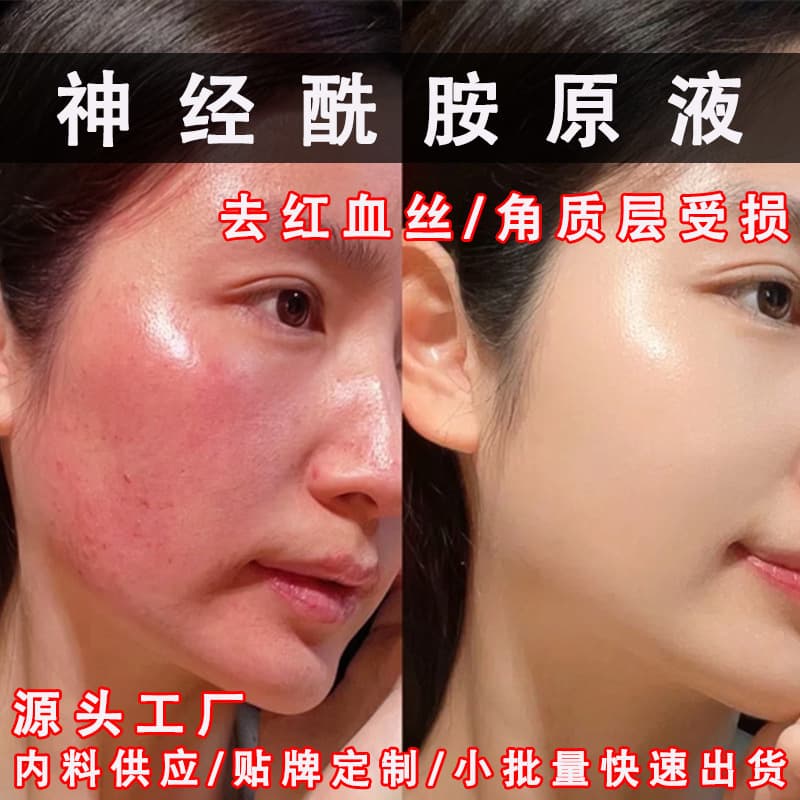Ceramide Serum for Post-Sun Repair, Thickening Stratum Corneum, Reducing Redness, Repairing Hormone-Damaged Skin, Beauty Clinic Essence