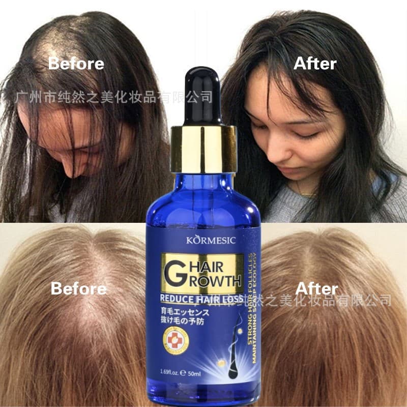 Cross-border Best-selling Hair Thickening Serum Anti-Hair Loss Hair Growth Serum Hair Oil