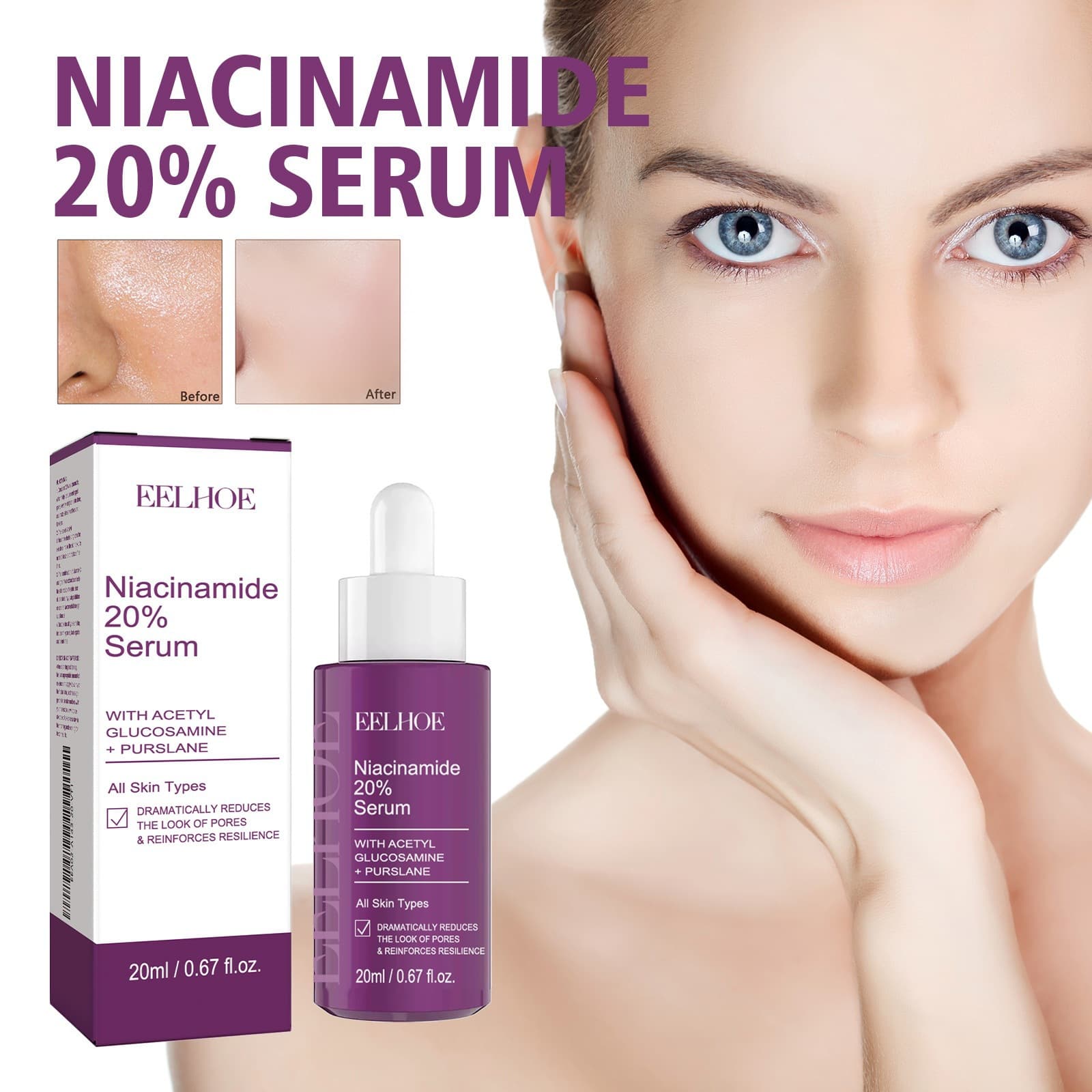 Cross-Border Eelhoe Niacinamide Elasticizing Essence Facial Skin Care Rejuvenating Brightening Spot Hydrating Essence