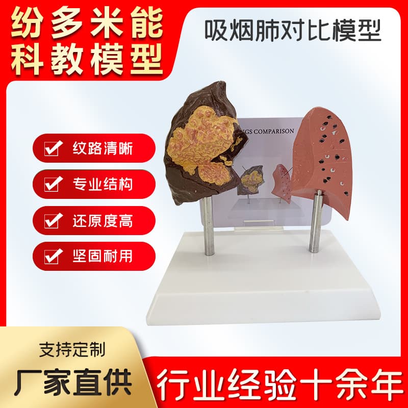 Human Smoking Lung vs Healthy Lung Comparison Model Smoker Lung Lesion Anatomy Respiratory System Teaching Model