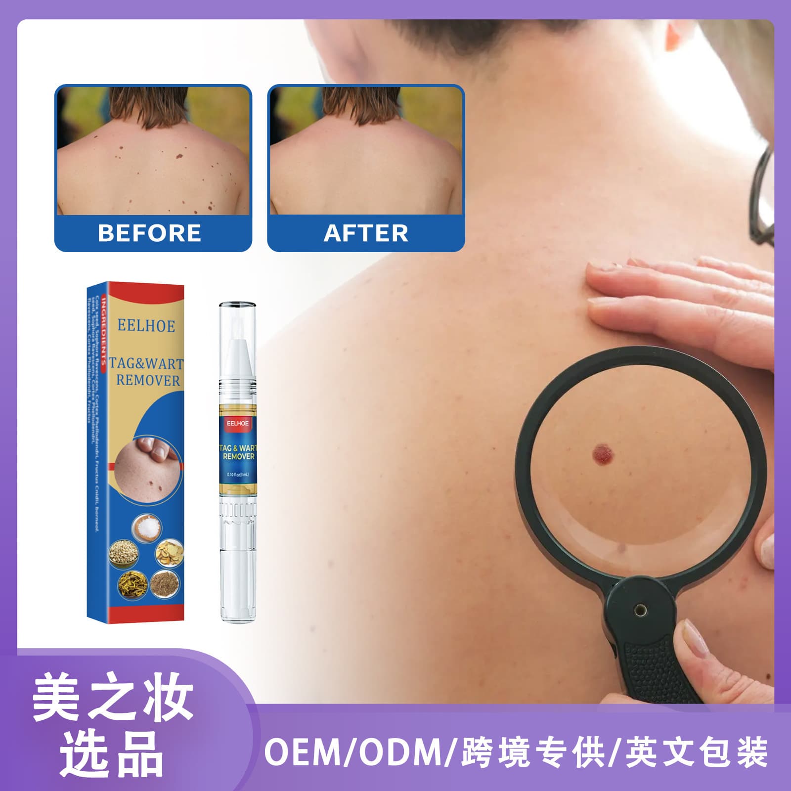EELHOE Skin Wart Removal Pen, Mole Removal Liquid, Body Skin Tape Removal and Wart Treatment, Skin Repairing and Care Solution