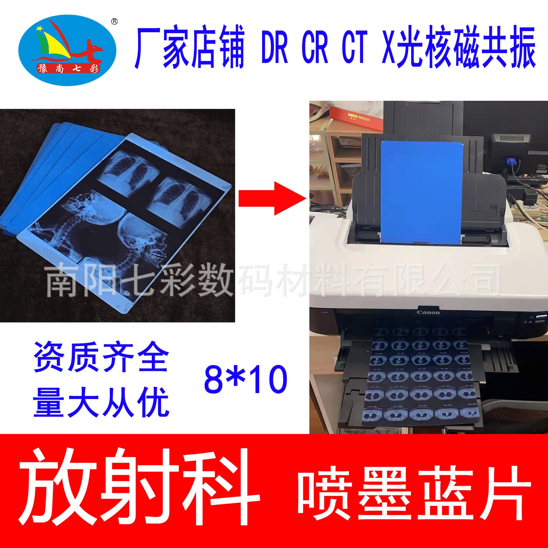 8*10 "Radiology Department orthopedic dental medical blue inkjet CT CR DR X-ray nuclear magnetic resonance printing film