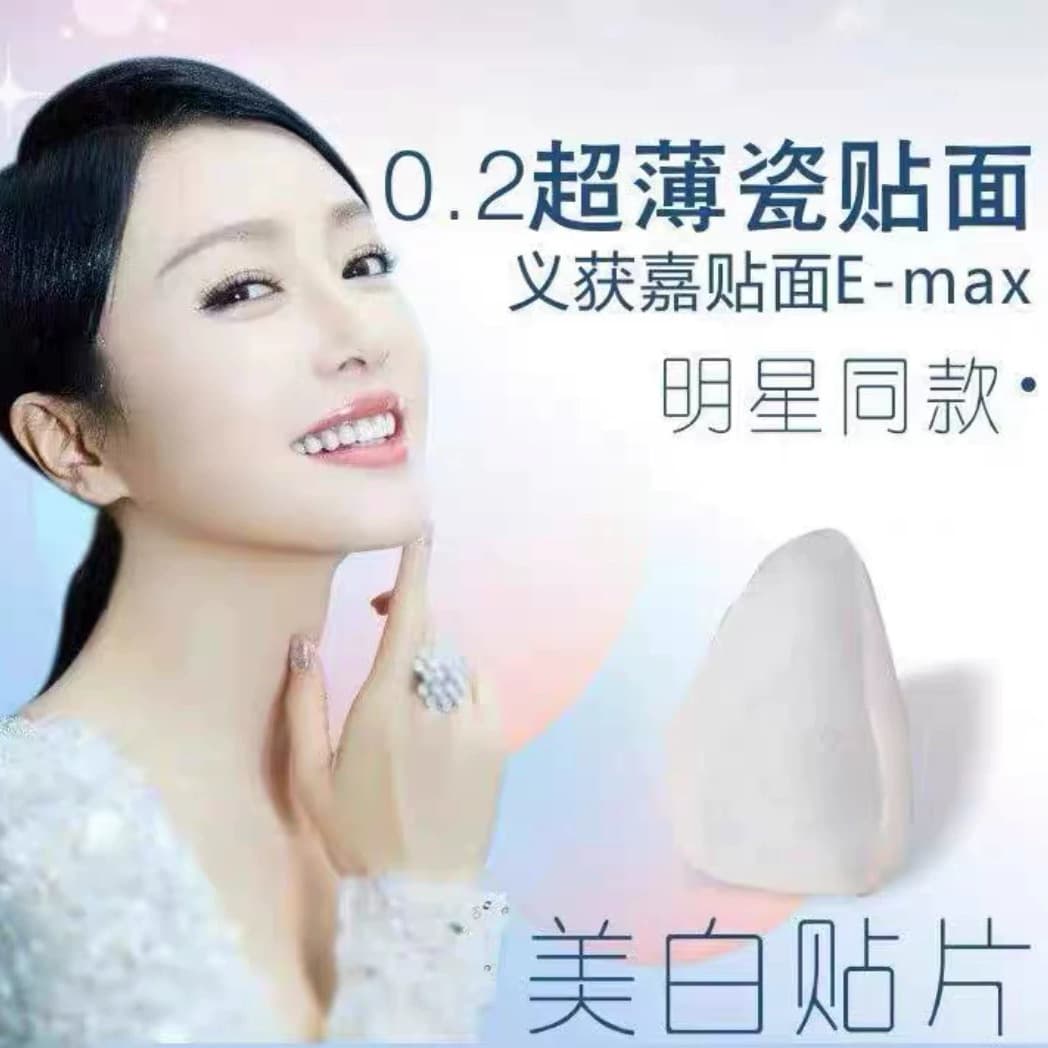 All-Ceramic Dental Veneer Ivoclar Blue Porcelain Ultra-Thin Veneer Amber Porcelain Veneer Glass Ceramic Dental Veneer