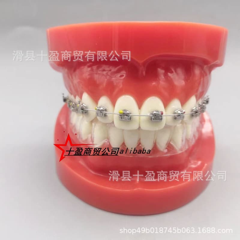 Dental Invisible Orthodontic Model for Doctor-Patient Communication, Teaching, and Oral Presentation - Teeth Model