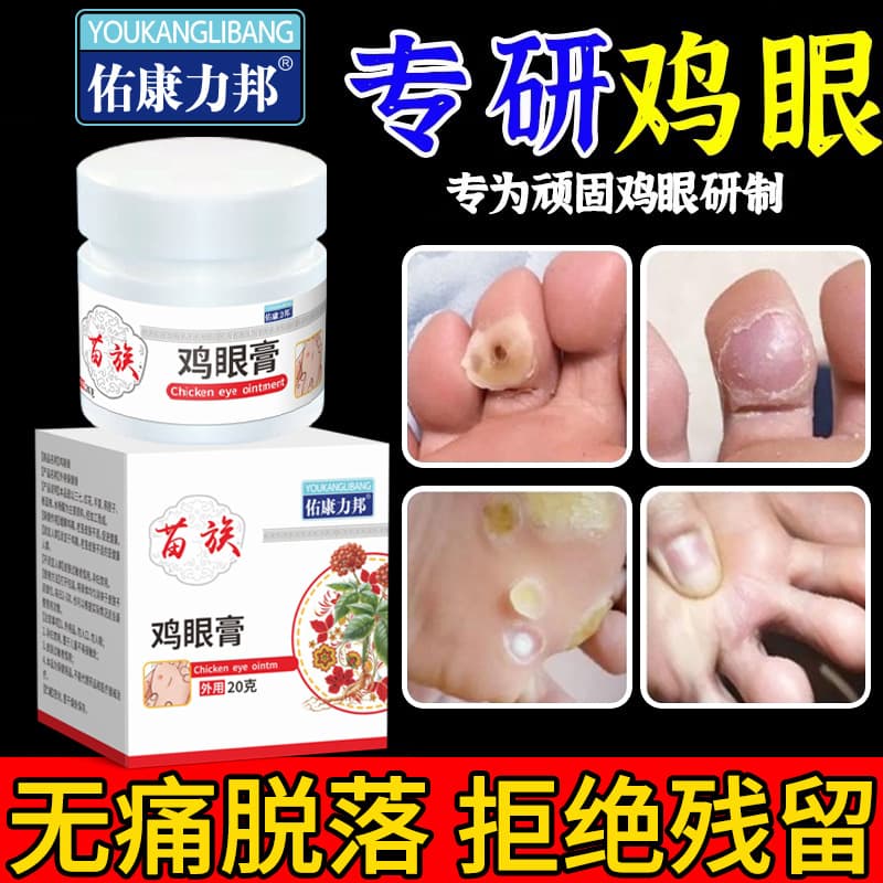 Youkang Libang Corn Plaster for Calluses, Foot Corns, and Dead Skin, Factory Direct