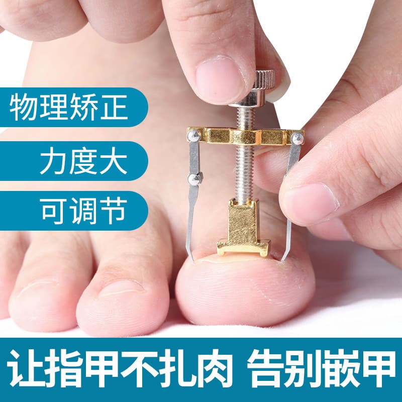 Ingrowing Nail Correction Kit Toe Nail Curling Growth Inside Meat Packaging Correction Tool Foot Care Set