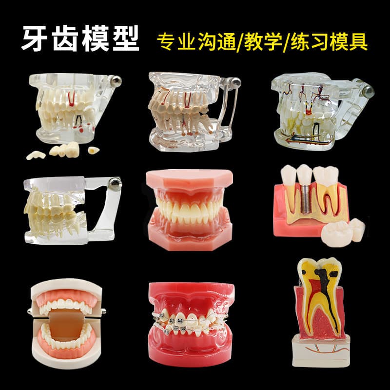 Dental Model Restoration Implant Model Full Mouth Pathological Model Standard Dental Model Dental Teaching Model