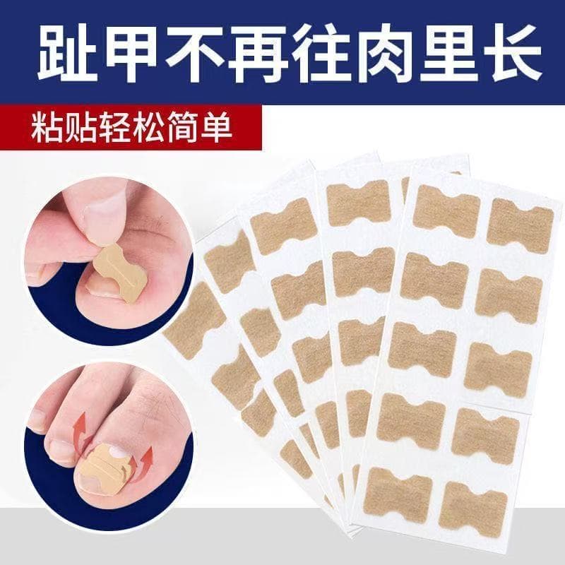 Ingrown Toenail Correction Patch Nail Groove Pad Home Toenail Straightener Nail Curling Corrector Nail Groove Repair Corrector