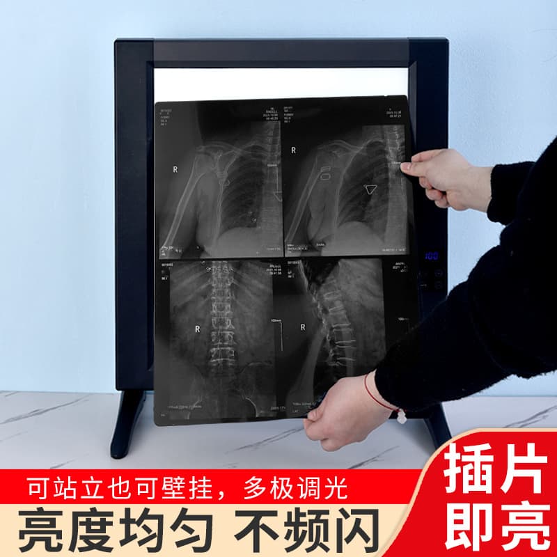 LED viewing lamp medical reading light box ultra-thin double orthopedic reading dental viewing lamp x-ray triple viewing film