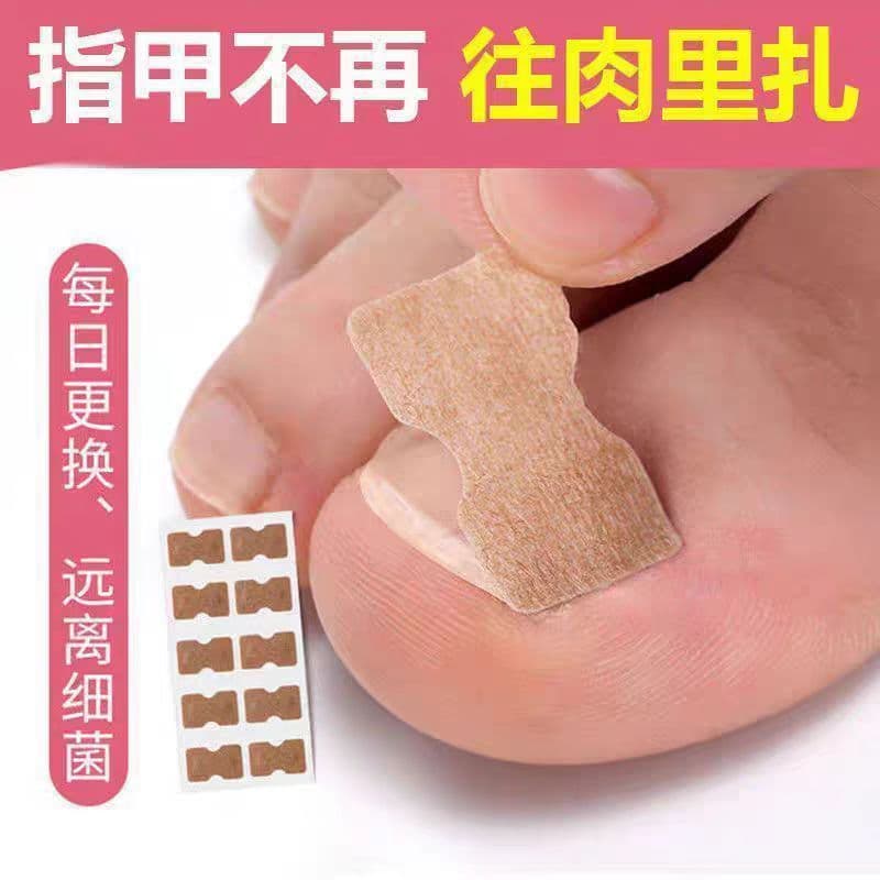 Glue-Free Toenail Correction Patch for Ingrown Toenails, Orthopedic Patch for Nail Groove Correction, Nail Groove Correction Patch for Manicure Use