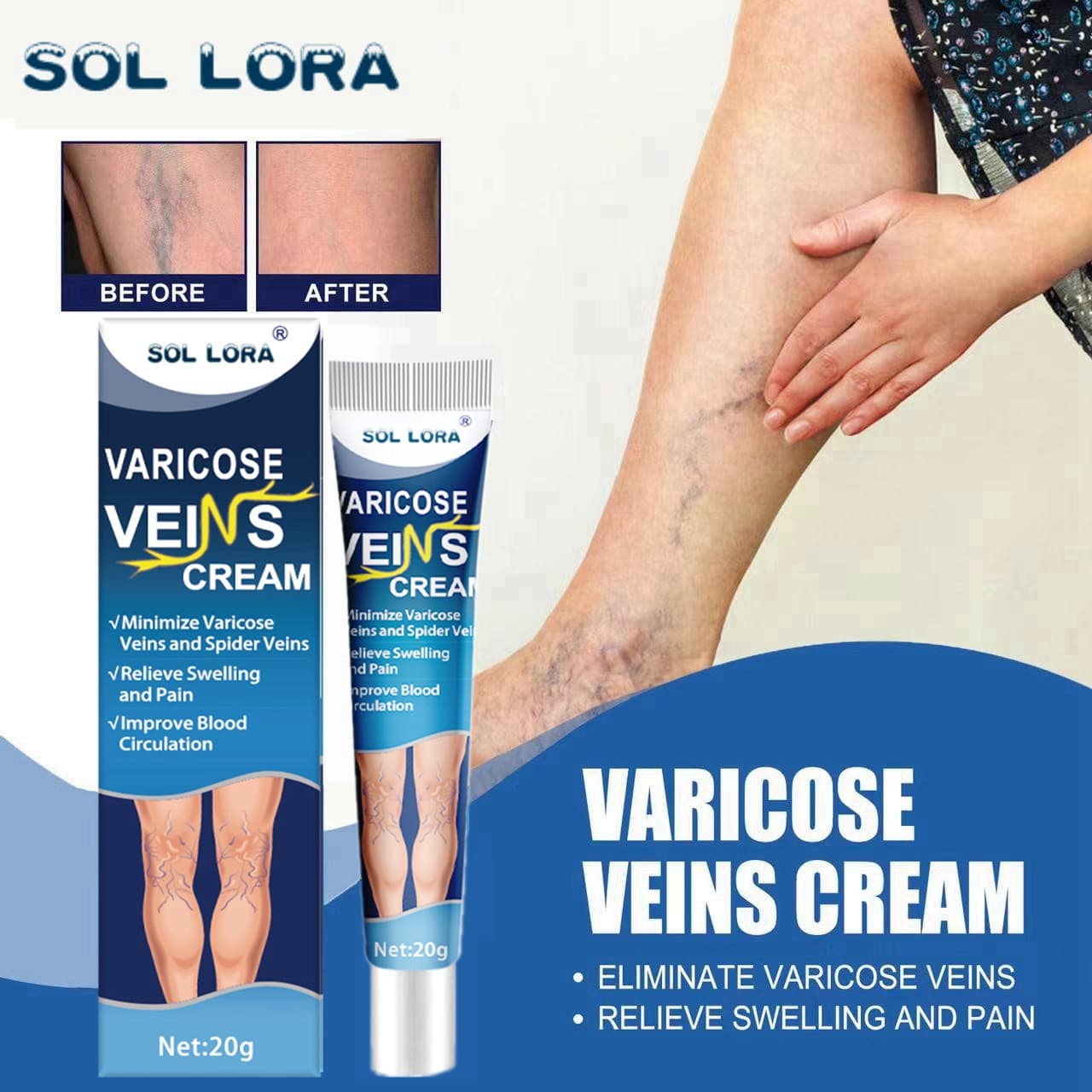 SOL LORA Varicose Vein Massage Cream for Leg Vein Relief, Repair Cream for Bulging Veins and Spider Veins