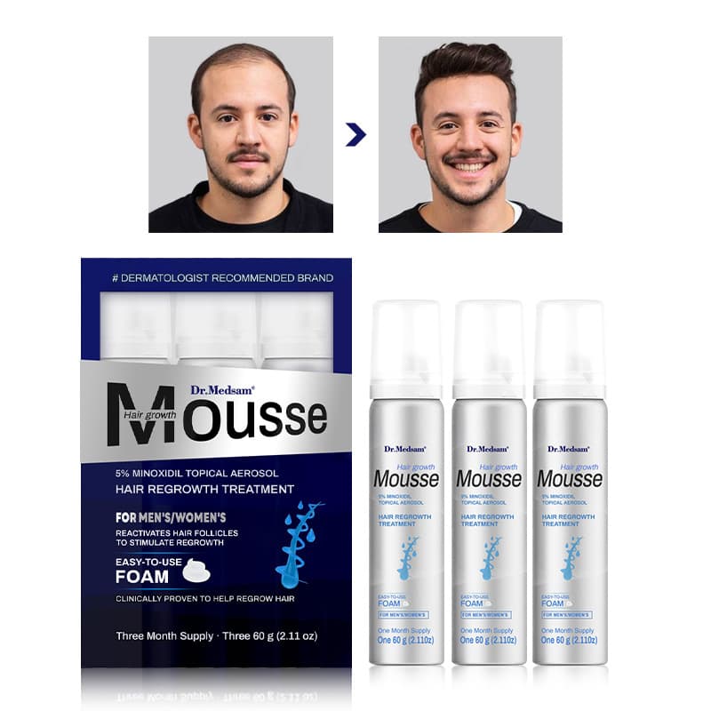 5% Minoxidil Hair Growth Foam Mousse Spray Cross-border Amazon Hair Growth Mousse
