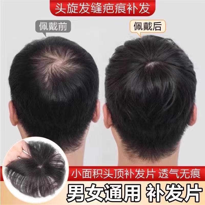 SiYue Men's Toupee Hairpiece Realistic Human Hair Crown Hairline Cover Scars Top Thinning Hair Loss