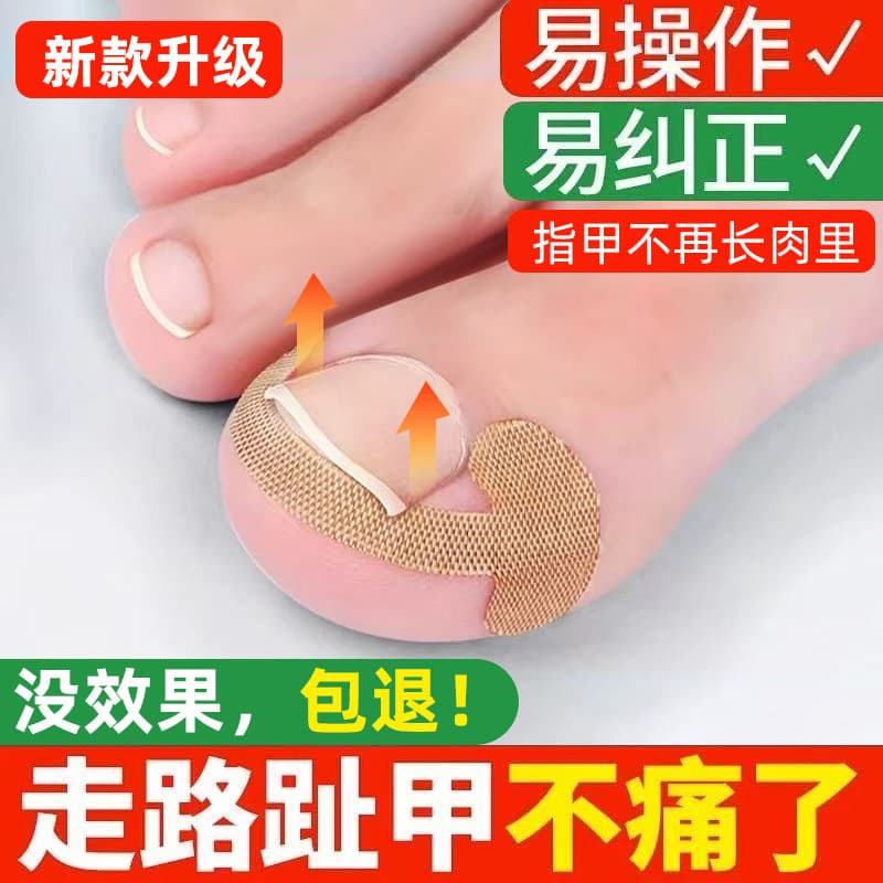 Toenail Ingrown Corrector for Thumb Curved Nails, Quick Fix for Deformed Toenails and Ingrown Skin