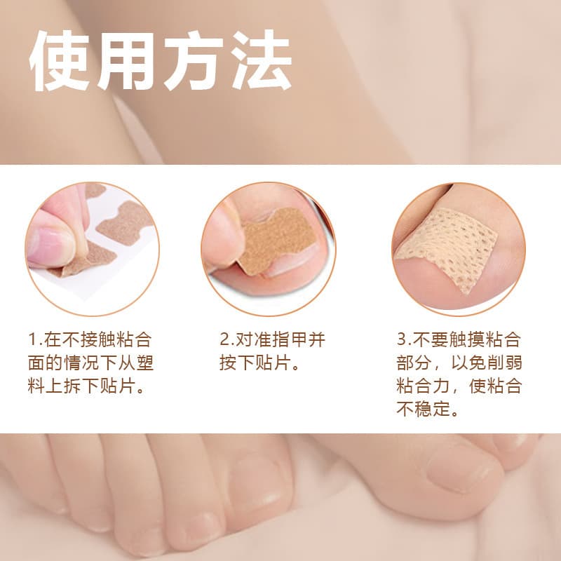 Nail Correction Patches for Ingrown Toenails and Toe Straightening, Manufacturer Direct
