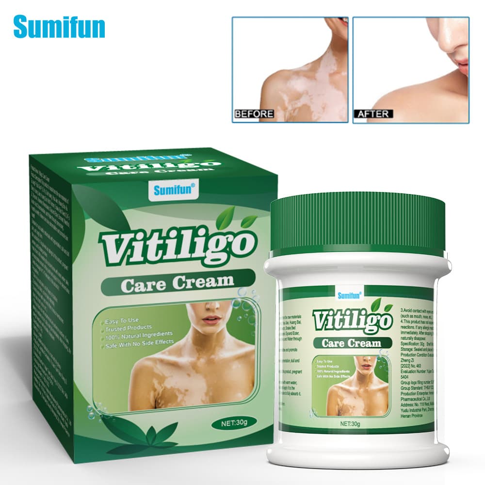 Sumifun Cross-border Plaster TK Skin Care Cream External Use Even Skin Tone Sweat Spots Tinea Versicolor Health Cream k20107