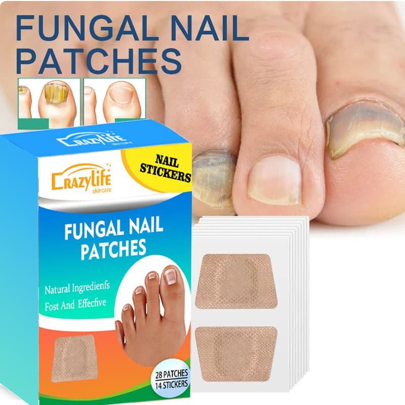 Crazylife Cross-border Nail Care Patches for Ingrown Nails, Nail Groove Ingrown Nails, Orthopedic Patches, Soft Nails, and Onychomycosis Repair Patches