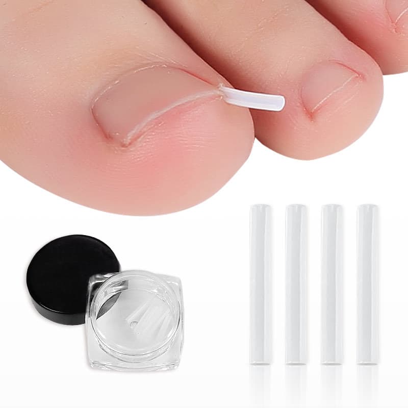 Ingrown Toenail Filling Pads Toenail Growing into Skin Nail Correctors Paronychia Filling Strips Nail Correction Patches Nail Repair Tools