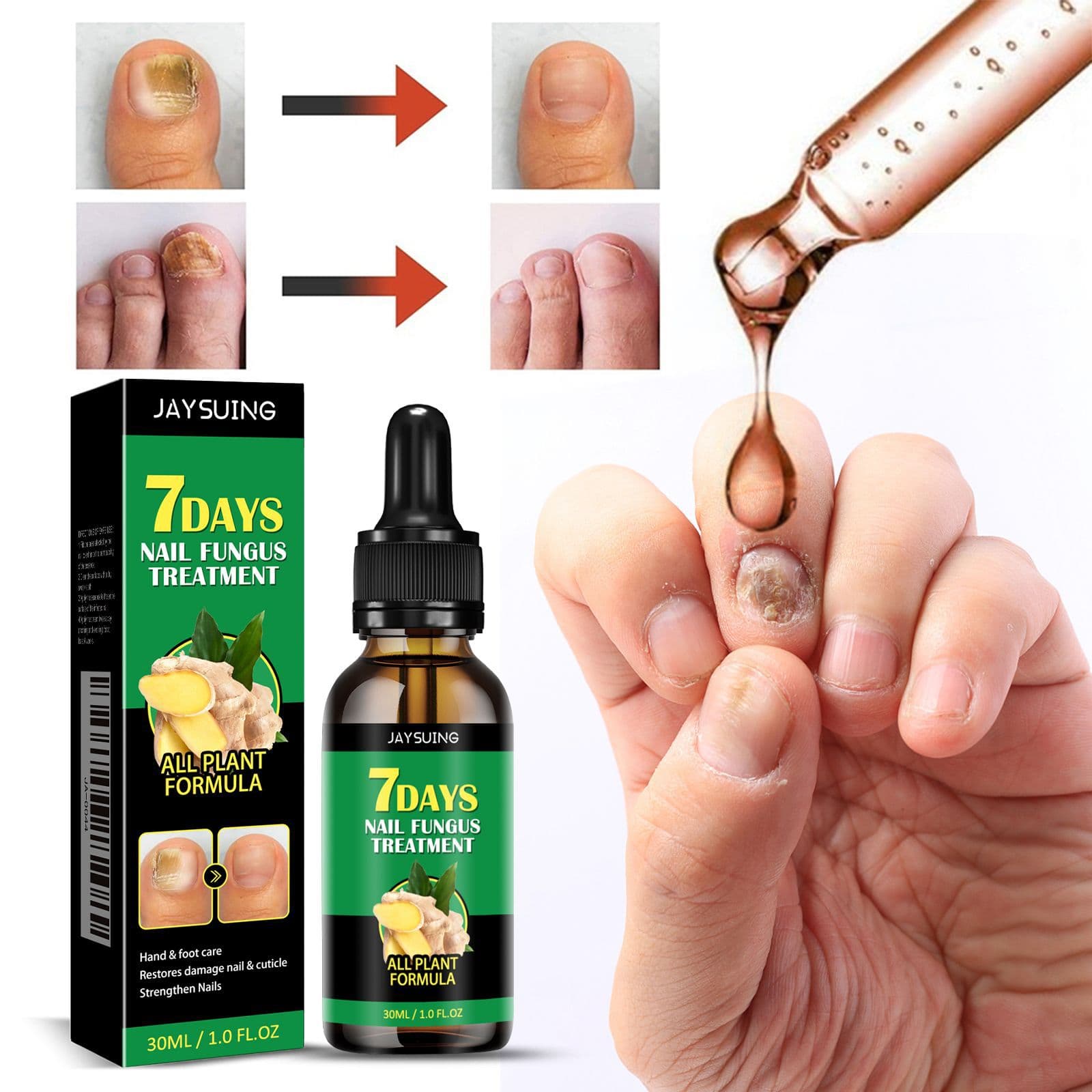 Jaysuing Ginger Nail Care Liquid Gentle Moisturizing Soft Nail Thick Nail Brightening Hand and Foot Nail Care Liquid